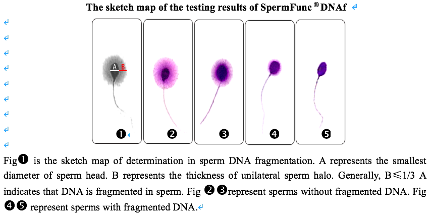Professional Sperm DNA Fragmentation Test Kit 40T/Kit BRED-002 Easy Operate