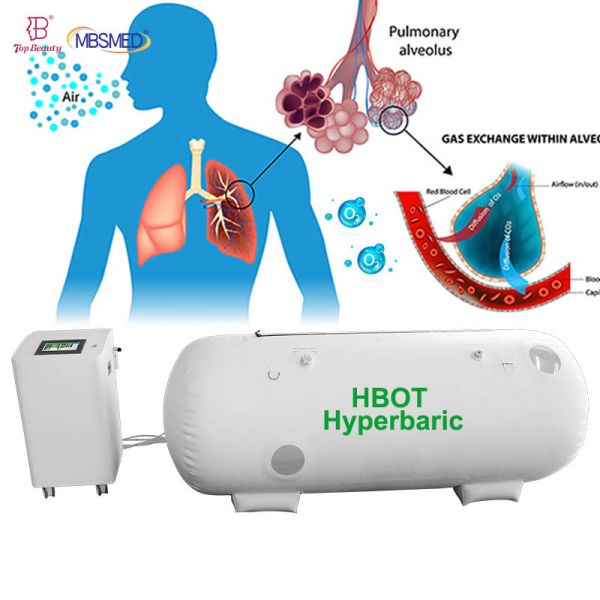 2.0ATA All-in-One HBOT Machine Air Compressor with Oxygen Generation 1.5ATA Hyperbaric Oxygen Chamber