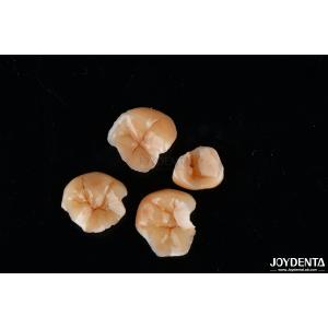China Customizable Shape Composite Inlays And Onlays Dental Stain Resistance Long Lasting on sale